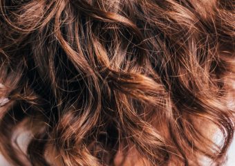 Are hair transplants always effective?