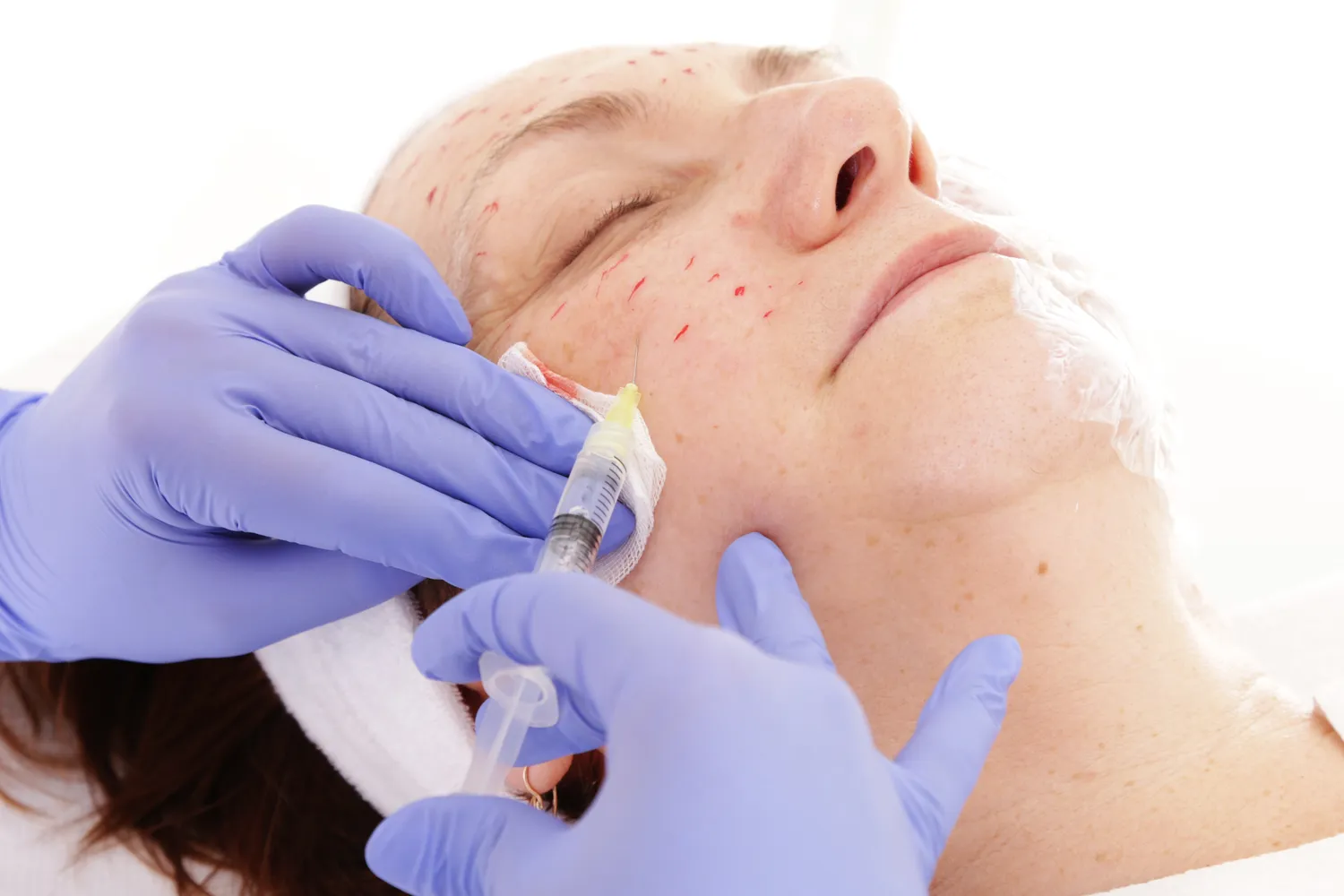 Kwas hialuronowy Szczecin