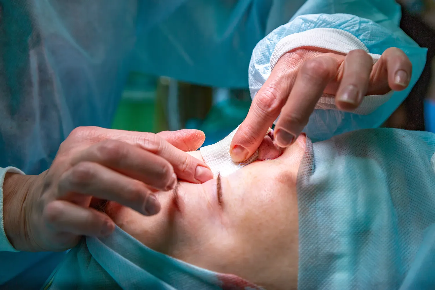 Wypozycjonowanie strony kliniki medycyny estetycznej