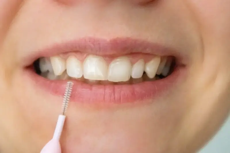 Dentysta - piękny uśmiech, białe zęby